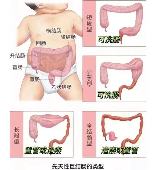 腹部外傷有內臟脫出時，腹部外傷導致內臟脫出 腹部外傷有內臟脫出時，腹部外傷導致內臟脫出 龍魚百科 第3張