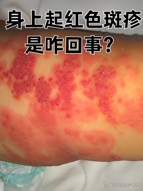 火龍魚中毒后有哪些治療方法，關(guān)于火龍魚中毒的一些建議