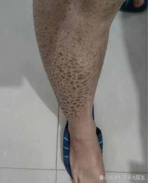 如何判斷魚是否患有爛鱗病,如何判斷魚是否患有爛鱗病、豎鱗病 龍魚百科 第6張 如何判斷魚是否患有爛鱗病,如何判斷魚是否患有爛鱗病、豎鱗病 如何判斷魚是否患有爛鱗病,如何判斷魚是否患有爛鱗病、豎鱗病 龍魚百科 第6張